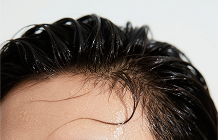 治头发出油的小偏方